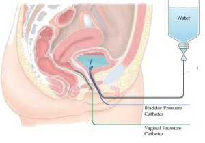 urodynamic testing